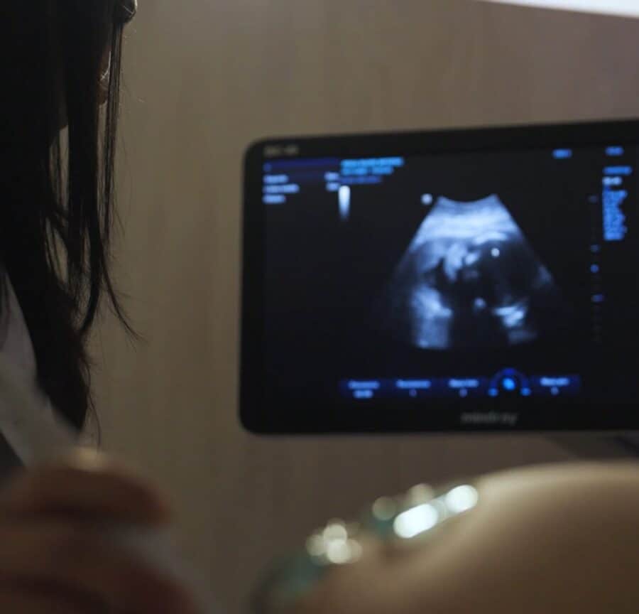 female doctor takes an ultrasound of a fetus at Reina Madre healthcare center